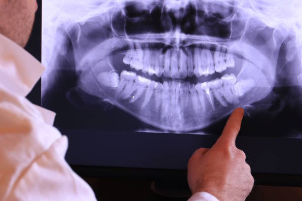 Best Emergency Treatment for Dental Infections or Abscesses in Wauwatosa, WI