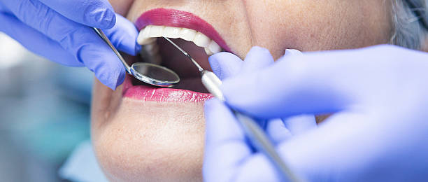 Best Emergency Root Canal Treatment in Wauwatosa, WI